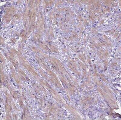 Immunohistochemistry-Paraffin: ADAM12 Antibody [NBP2-33939]