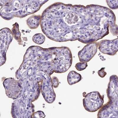 Immunohistochemistry-Paraffin: ADAM12 Antibody [NBP2-33940]