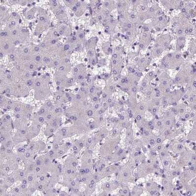 Immunohistochemistry-Paraffin: ADAM12 Antibody [NBP2-33940]