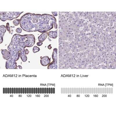 Immunohistochemistry-Paraffin: ADAM12 Antibody [NBP2-33940]