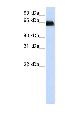 Western Blot: ADAM12 Antibody [NBP1-59142]