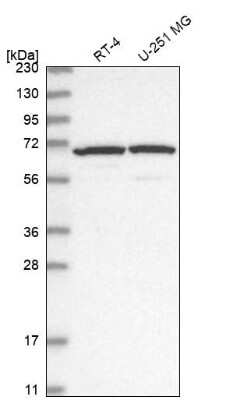 Western Blot: ADAM12 Antibody [NBP2-33940]