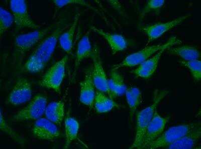 Immunocytochemistry/ Immunofluorescence: ADAM15 Antibody (007) [NBP2-89546]