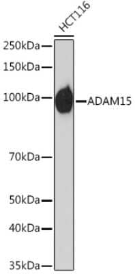 Western Blot: ADAM15 Antibody (4T4X10) [NBP3-16642]