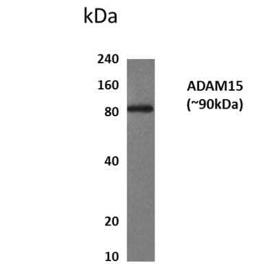 Western Blot: ADAM15 Antibody (MM0078-9H34)Azide and BSA Free [NBP2-12017]