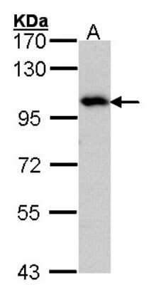 Western Blot: ADAM15 Antibody [NBP1-31526]