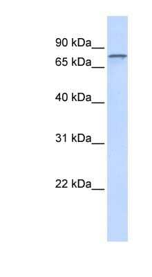 Western Blot: ADAM15 Antibody [NBP1-59198]