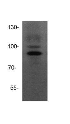 Western Blot: ADAM15 Antibody [NBP1-59198]