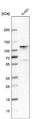 Western Blot: ADAM15 Antibody [NBP1-82788]