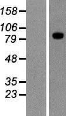 Western Blot: ADAM15 Overexpression Lysate [NBP2-07949]