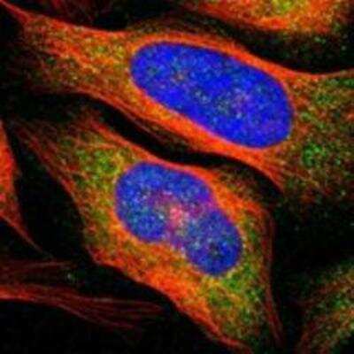 Immunocytochemistry/ Immunofluorescence: TACE/ADAM17 Antibody [NBP1-86546]