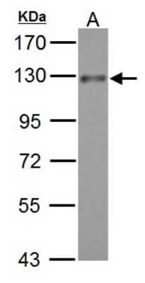 Western Blot: TACE/ADAM17 Antibody [NBP2-15281]