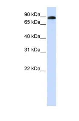 Western Blot: ADAM19 Antibody [NBP1-69364]