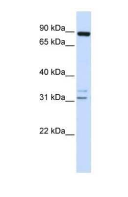 Western Blot: ADAM19 Antibody [NBP1-69367]