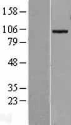 Western Blot: ADAM19 Overexpression Lysate [NBL1-07307]