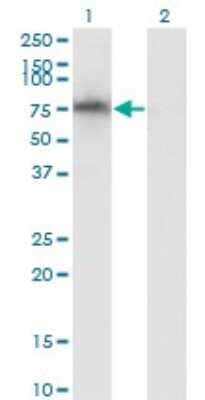 Western Blot: ADAM2 Antibody (1B8) [H00002515-M02]