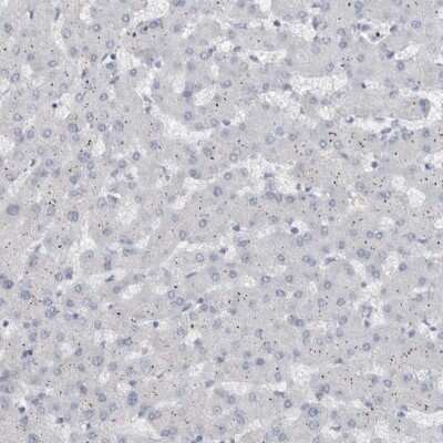 Immunohistochemistry-Paraffin: ADAM2 Antibody [NBP1-85415]