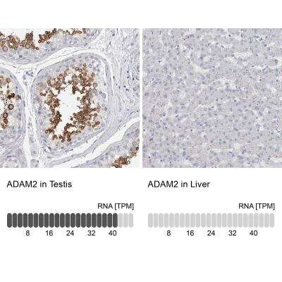 Immunohistochemistry-Paraffin: ADAM2 Antibody [NBP1-85415]