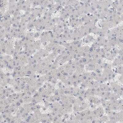 Immunohistochemistry-Paraffin: ADAM2 Antibody [NBP1-85416]