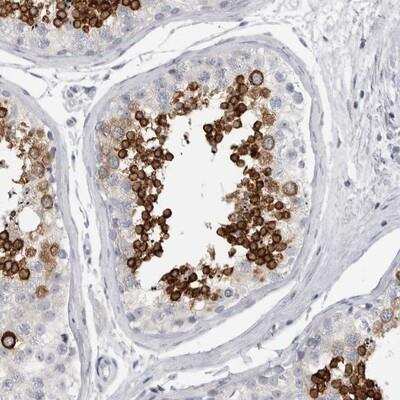 Immunohistochemistry-Paraffin: ADAM2 Antibody [NBP1-85416]
