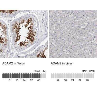 Immunohistochemistry-Paraffin: ADAM2 Antibody [NBP1-85416]