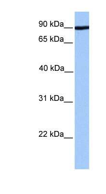 Western Blot: ADAM2 Antibody [NBP1-59224]