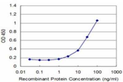 ELISA: ADAM20 Antibody (4B10) [H00008748-M05]