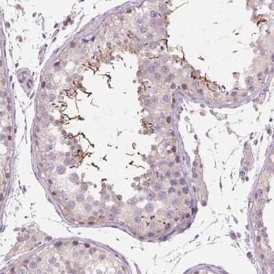 Immunohistochemistry-Paraffin: ADAM20 Antibody [NBP2-38872]