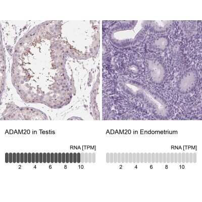 Immunohistochemistry-Paraffin: ADAM20 Antibody [NBP2-38872]