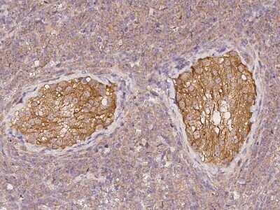 Immunohistochemistry-Paraffin: ADAM20 Antibody [NBP2-98032]