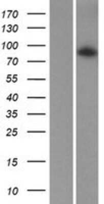 Western Blot: ADAM20 Overexpression Lysate [NBP2-07948]