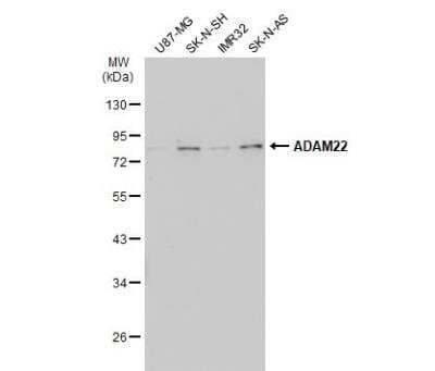 Western Blot: ADAM22 Antibody [NBP2-15282]