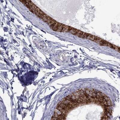 Immunohistochemistry-Paraffin: ADAM28 Antibody [NBP2-55995]