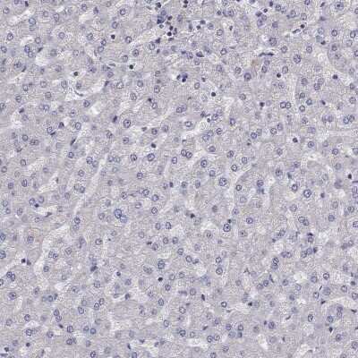 Immunohistochemistry-Paraffin: ADAM28 Antibody [NBP2-55995]