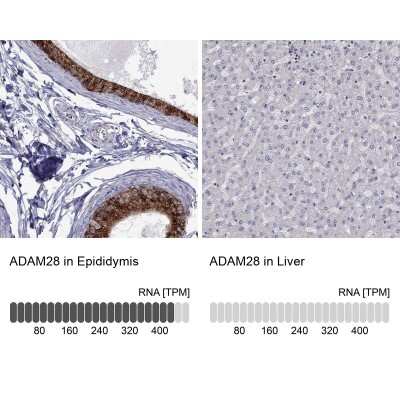 Immunohistochemistry-Paraffin: ADAM28 Antibody [NBP2-55995]