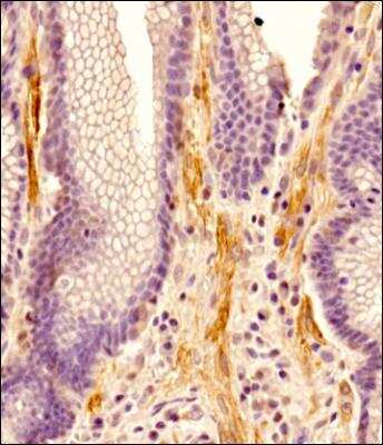 Immunohistochemistry-Paraffin: ADAM28 Antibody - BSA Free [NBP2-67246]