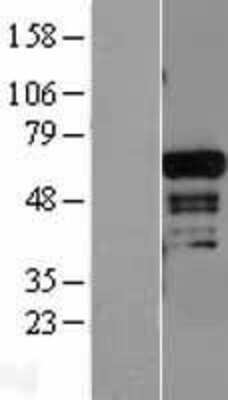 Western Blot: ADAM28 Overexpression Lysate [NBL1-07309]