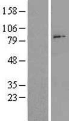 Western Blot: ADAM28 Overexpression Lysate [NBL1-07310]