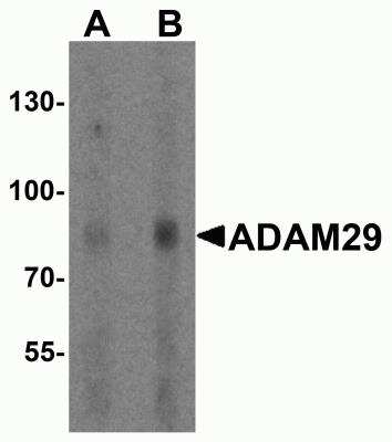 Western Blot: ADAM29 AntibodyBSA Free [NBP2-81697]