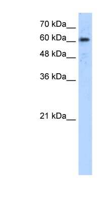 Western Blot: ADAM30 Antibody [NBP1-62289]