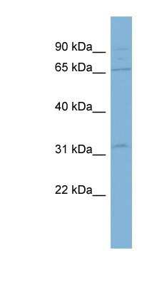 Western Blot: ADAM30 Antibody [NBP1-62430]