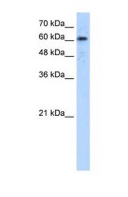 Western Blot: ADAM30 Antibody [NBP1-69319]