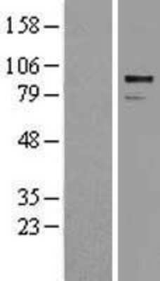 Western Blot: ADAM30 Overexpression Lysate [NBL1-07311]