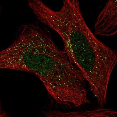 Immunocytochemistry/ Immunofluorescence: ADAM32 Antibody [NBP2-55758]