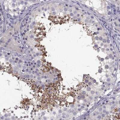 Immunohistochemistry-Paraffin: ADAM32 Antibody [NBP1-86198]