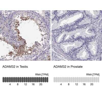 Immunohistochemistry-Paraffin: ADAM32 Antibody [NBP1-86198]