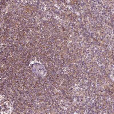 Immunohistochemistry-Paraffin: ADAM33 Antibody [NBP2-49509]