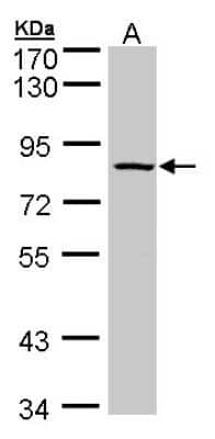 Western Blot: ADAM33 Antibody [NBP1-30898]