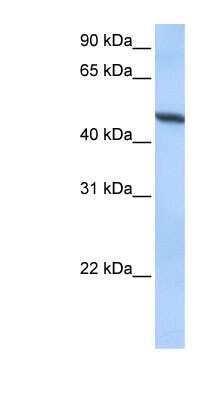 Western Blot: ADAM33 Antibody [NBP1-59046]