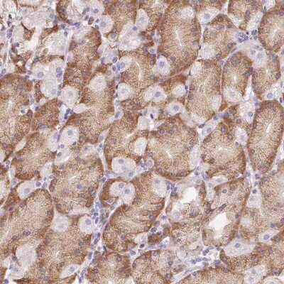 Immunohistochemistry: ADAM8 Antibody [NBP2-39031]